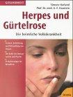 Herpes und Gürtelrose