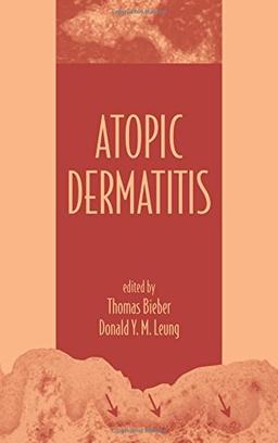 Atopic Dermatitis