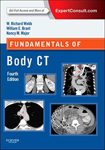 Fundamentals of Body CT: Expert Consult - Online and Print (Fundamentals of Radiology)