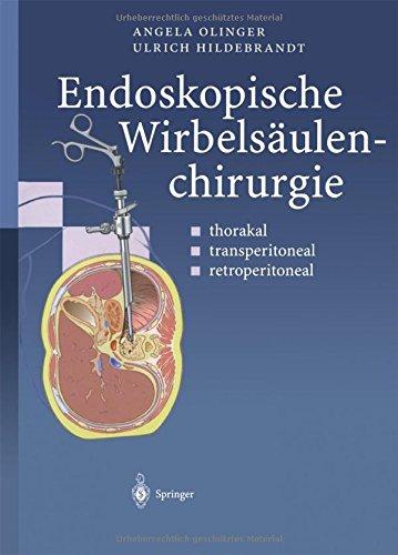 Endoskopische Wirbelsäulenchirurgie: Thorakal · Transperitoneal · Retroperitoneal (German Edition)