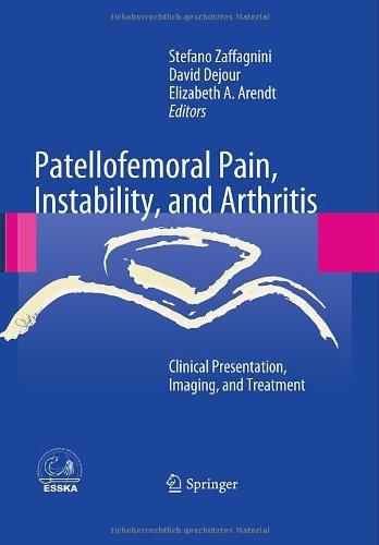 Patellofemoral Pain, Instability, and Arthritis: Clinical Presentation, Imaging, and Treatment