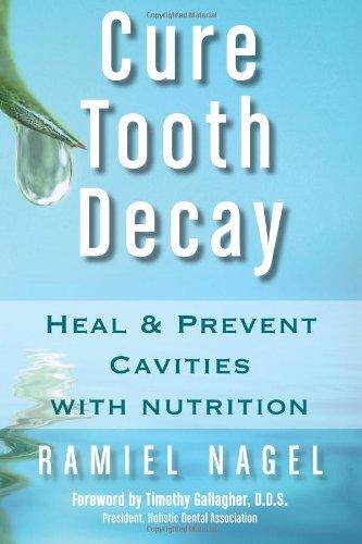 Cure Tooth Decay: Heal and Prevent Cavities With Nutrition