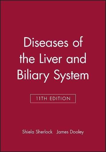 Diseases of the Liver and Biliary System