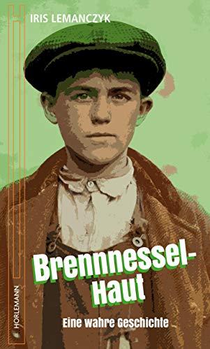 Brennnessel Haut: Eine wahre Geschichte