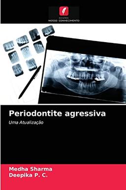 Periodontite agressiva: Uma Atualização