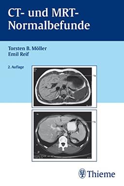 CT und MRT Normalbefunde