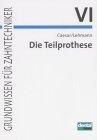 Die Teilprothese: Grundwissen für Zahntechniker