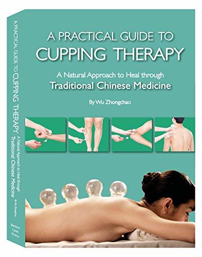 Practical Guide to Cupping Therapy: A Natural Approach to Heal Through Traditional Chinese Medicine