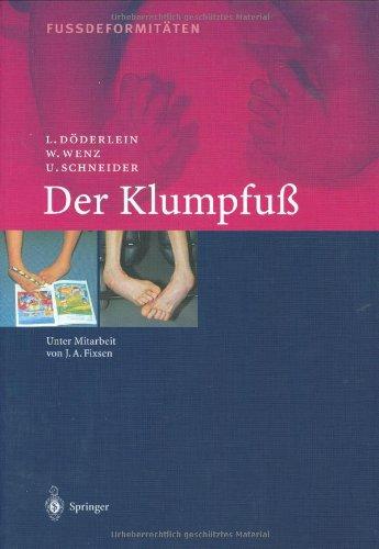 Der Klumpfuss: Erscheinungsformen und Behandlungsprinzipien jeden Alters. Differentialdiagnose und Differentialtherapie