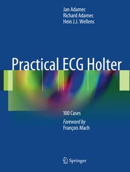 Practical ECG Holter: 100 Cases