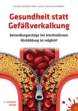 Gesundheit statt Gefäßverkalkung: Behandlungserfolge bei Arteriosklerose - Rückbildung ist möglich!