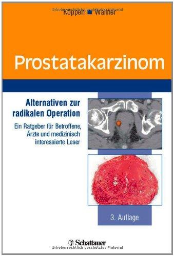 Prostatakarzinom: Alternativen zur radikalen Operation. Ein Ratgeber für Betroffene, Ärzte und medizinisch interessierte Leser