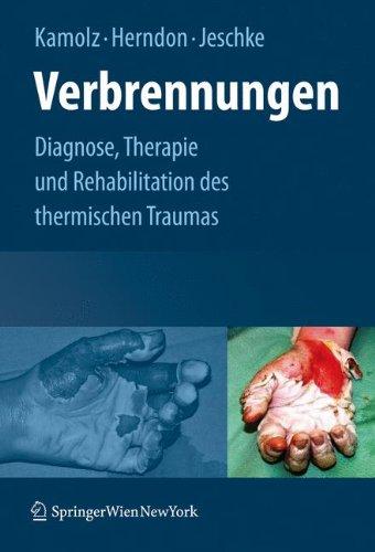 Verbrennungen: Diagnose, Therapie und Rehabilitation des thermischen Traumas