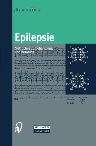 Epilepsie. Nützliches zu Behandlung und Beratung