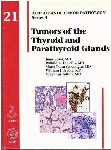 Tumors of the Thyroid and Parathyroid Glands (Atlas of Tumor Pathology)