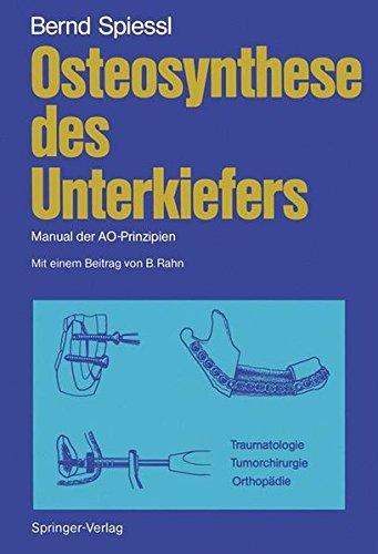 Osteosynthese des Unterkiefers