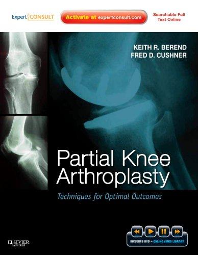 Partial Knee Arthroplasty: Techniques for Optimal Outcomes: Techniques for Optimal Outcomes with DVD; Expert Consult - Online & Print