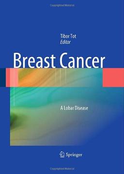 Breast Cancer: A Lobar Disease