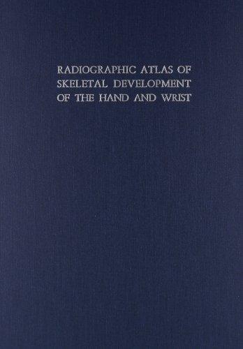 Radiographic Atlas of Skeletal Development of the Hand and Wrist