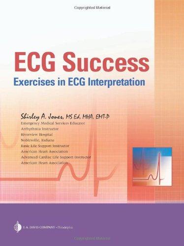 ECG Success! Exercises in ECG Interpretation