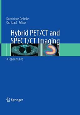 Hybrid PET/CT and SPECT/CT Imaging: A Teaching File