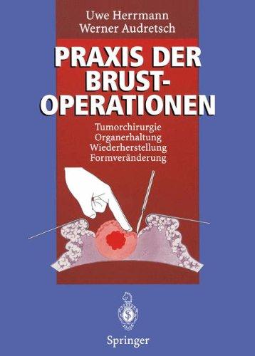 Praxis der Brustoperationen: Tumorchirurgie _ Organerhaltung _ Wiederherstellung _ Formveränderung