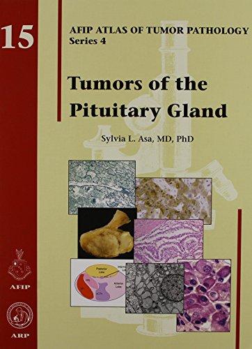 Tumors of the Pituitary Gland (Atlas of Tumor Pathology (Afip) 3rd)