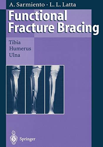 Functional Fracture Bracing: Tibia, Humerus, and Ulna