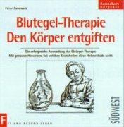 Blutegel-Therapie