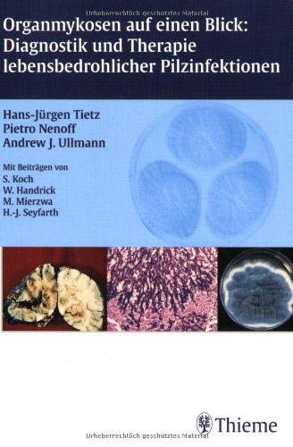 Organmykosen auf einen Blick: Diagnostik und Therapie lebensbedrohlicher Pilzinfektionen. Diagnostik und Therapie lebensbedrohlicher Pilzinfektionen