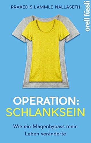 Operation: Schlanksein: Wie ein Magenbypass mein Leben veränderte