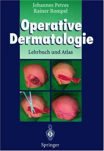 Operative Dermatologie: Lehrbuch und Atlas