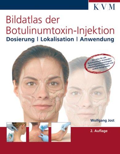 Bildatlas der Botulinumtoxin-Injektion: Dosierung|Lokalisation|Anwendung