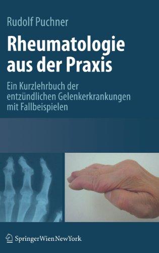 Rheumatologie aus der Praxis: Kurzlehrbuch der entzündlichen Gelenkerkrankungen mit Fallbeispielen