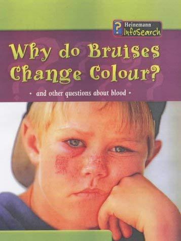 Body Matters Why do bruises change colour