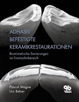 Adhäsiv befestigte Keramikrestaurationen: Biomimetische Sanierungen im Frontzahnbereich