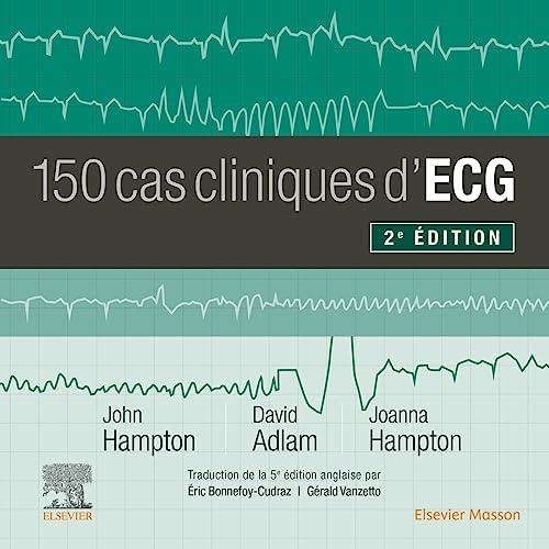 150 cas cliniques d'ECG