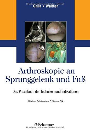 Arthroskopie an Sprunggelenk und Fuß: Das Praxisbuch der Techniken und Indikationen