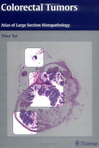 Colorectal Tumors: Atlas of Large Section Histopathology