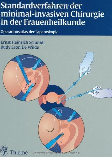 Standardverfahren der minimal-invasiven Chirurgie in der Frauenheilkunde: Operationsatlas der Laparoskopie