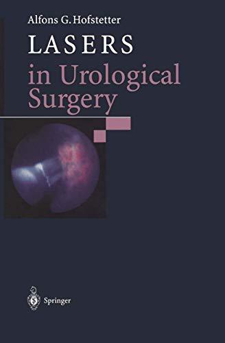 Lasers in Urological Surgery