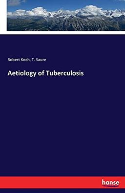 Aetiology of Tuberculosis