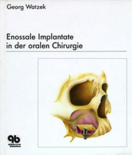 Enossale Implantate in der oralen Chirurgie