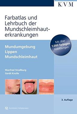 Farbatlas und Lehrbuch der Mundschleimhauterkrankungen: Mundumgebung,Lippen, Mundschleimhaut