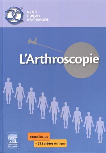 L'arthroscopie