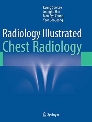 Radiology Illustrated: Chest Radiology