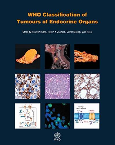 Who Classification of Tumours of Endocrine Organs (World Health Organization Classification of Tumours)