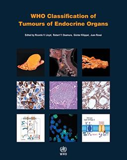 Who Classification of Tumours of Endocrine Organs (World Health Organization Classification of Tumours)