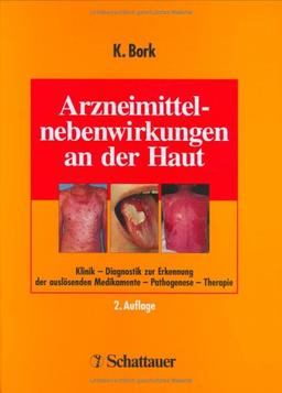 Arzneimittelnebenwirkungen an der Haut