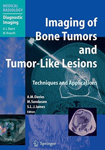 Imaging of Bone Tumors and Tumor-Like Lesions: Techniques and Applications (Medical Radiology)